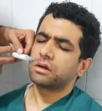 دامپزشک بخش خصوصی کاشمر در پی جراحی عقیم&zwnj;سازی سگ بلاصاحب از ناحیه صورت به شدت مصدوم شد