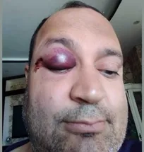 &laquo;دکتر احسانی&raquo; از کارکنان اداره دامپزشکی شهرستان شیراز در اثر ضربه لگد اسب از ناحیه چشم مصدوم شد