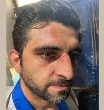 دامپزشک اداره دامپزشکی شهرستان فردوس در پی اصابت ضربه لگد گاو به صورت و بینی مصدوم شد