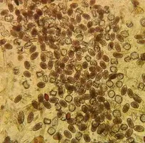گزارش مواجهه با یک بیماری همه&zwnj;گیر - دکتر مرتضی توکل&zwnj;نیا