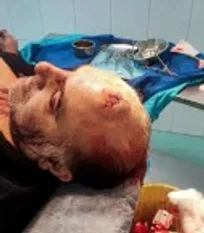 دکتر دامپزشک و مسئول فدراسیون سوارکاری بر اثر حمله افراد ناشناس با قمه به شدت آسیب دید