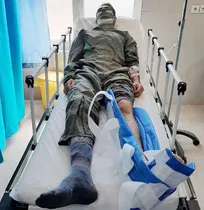مصدومیت شدید پای کارشناس دامپزشکی اردستان در حین انجام واکسیناسیون در یک گاوداری
